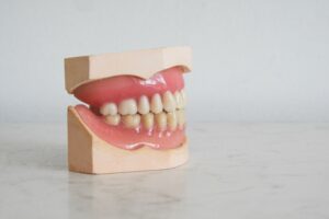 치은염 이빨